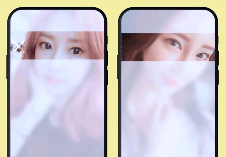목동쌍수 매몰? 절개? 부분절개? 뭐가 더 좋나요 관련 이미지 2