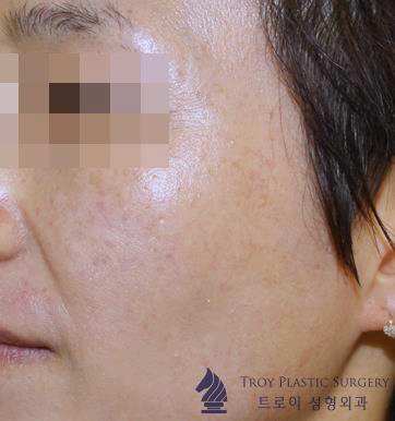 목동역피부관리 잘하는 곳 특징 2가지 관련 이미지 2