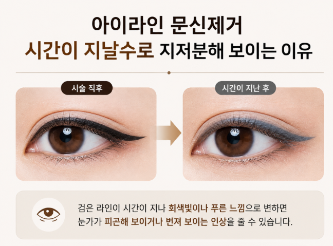 Mok-dong Eyeliner Tattoo Removal: What Matters More Than Color Is the Way It Has Spread image 2