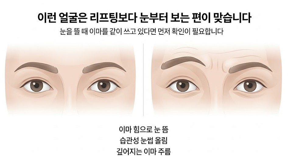목동 중년성형, 리프팅보다 눈부터 봐야 하는 얼굴의 특징 관련 이미지 3