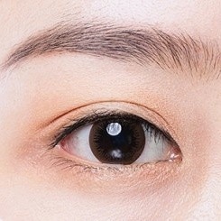 강서구눈성형 잘하는곳? 쌍수 부작용 예방 팁 관련 이미지 3