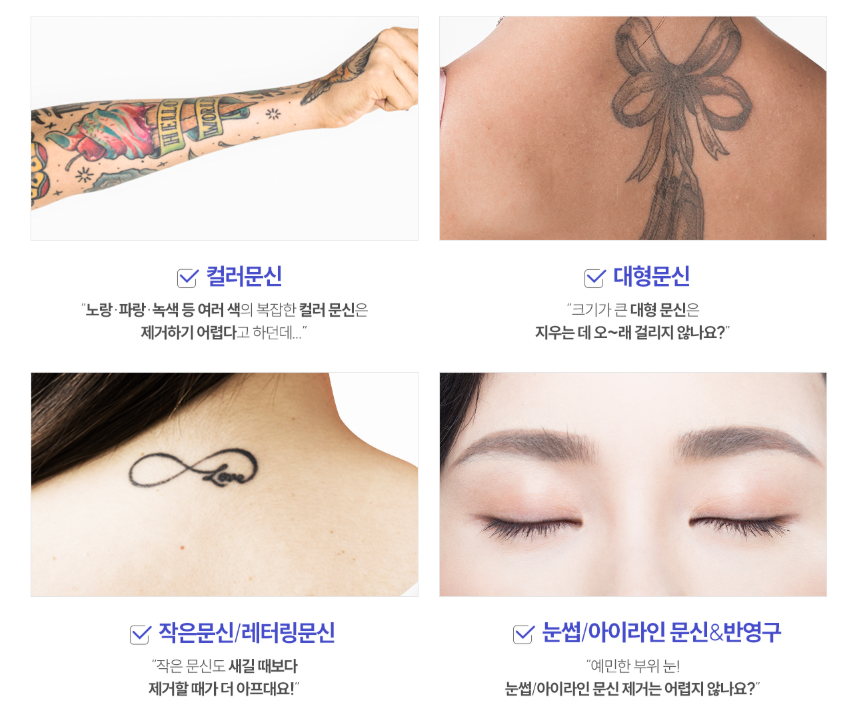 목동문신제거 안전하게 제거하는 스타워커 장비란? 관련 이미지 4