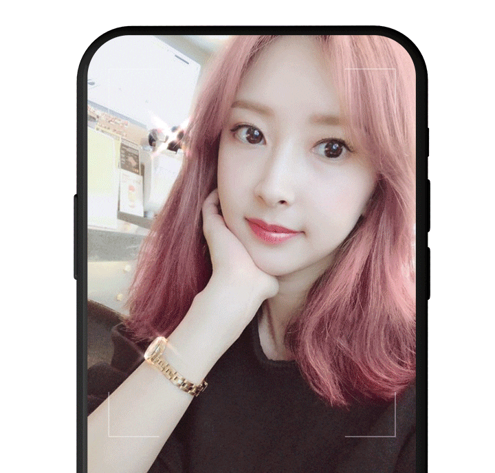 영등포쌍수 매몰법vs절개법 나에게 어울리는 수술 방법은 뭘까 관련 이미지 2