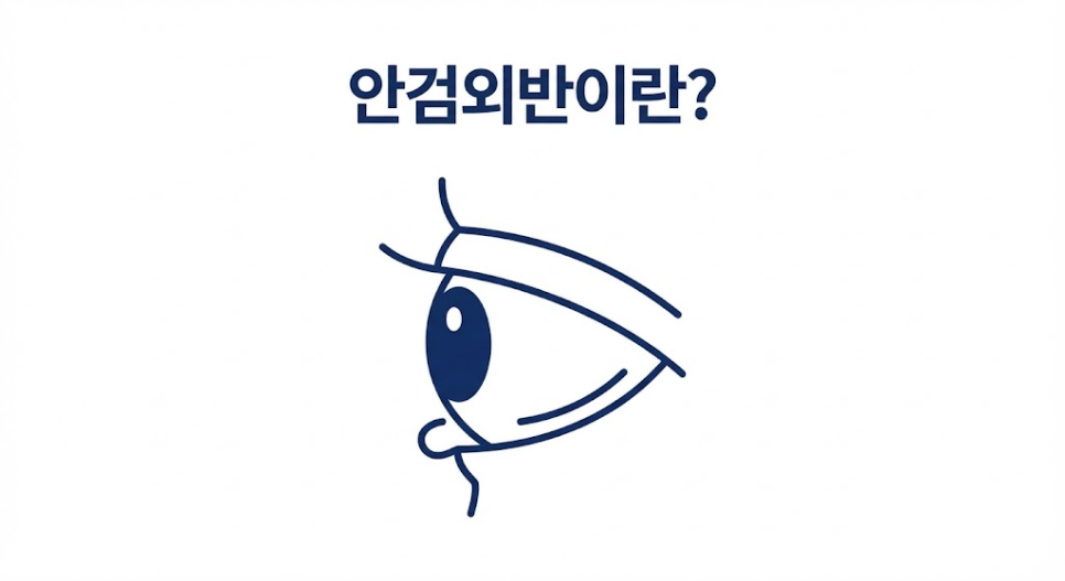 눈시림과 안구건조증, 안검외반 교정술을 받아야 하는 신호일까? 관련 이미지 2