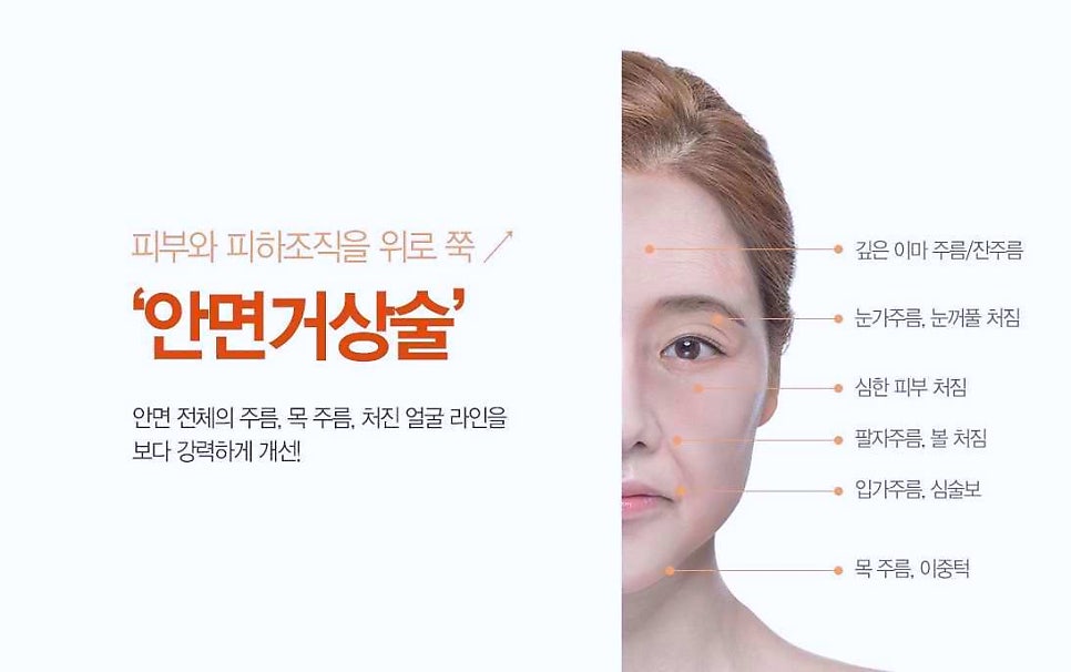 김포성형외과 동안성형 잘하는 곳에서 추천하는 시/수술 3가지 관련 이미지 1