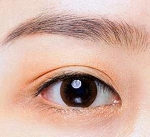 Mokdong Station Double Eyelid Surgery: Are the Surgical Methods Different for Protruding Eyes and Deep-Set Eyes? Don’t Regret Not Knowing image 3