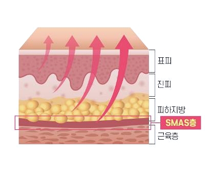 목동역이마거상 부작용? 흉터? 이걸로 종결합니다 관련 이미지 2