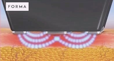 목동인모드 잘하는 곳 찾는다면 관련 이미지 3