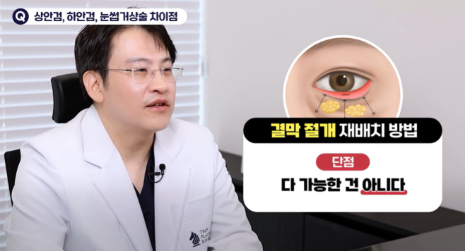 눈밑지방재배치, 이런 경우에는 효과가 제한적일 수 있습니다 관련 이미지 5