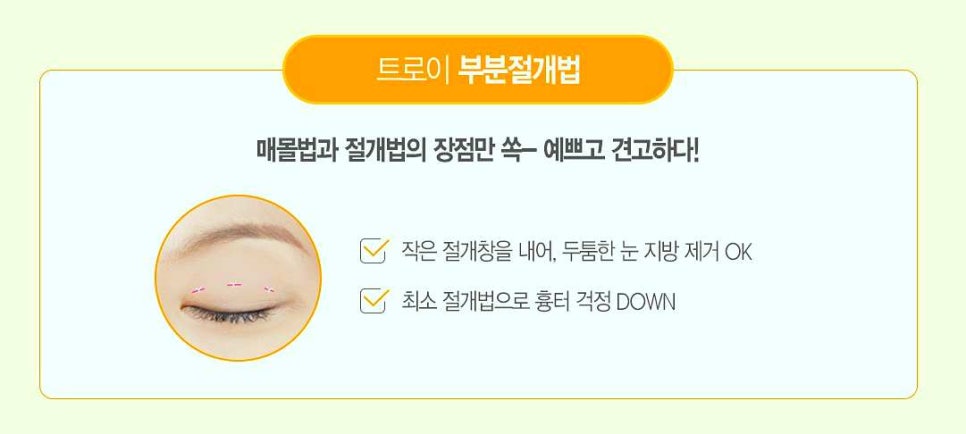 영등포쌍수 매몰vs절개 나에게 적합한 수술 방법은? 관련 이미지 2
