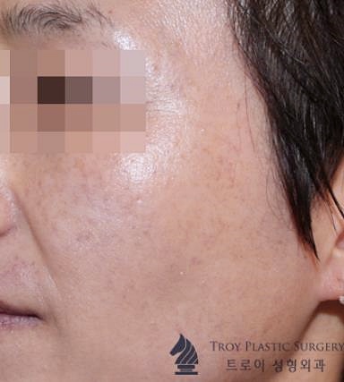 강서구피부관리 제대로 효과 보려면 확인해야 할 2가지 관련 이미지 3