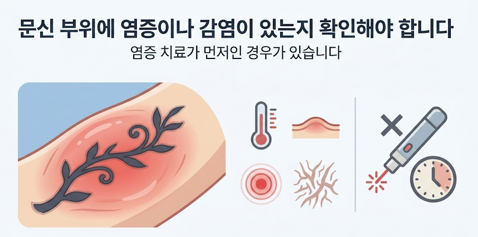 목동문신제거 고민 중이라면, 먼저 확인해야 할 중요한 기준들 관련 이미지 5