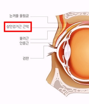 강서구눈매교정 흉터가 걱정된다면 보세요 관련 이미지 1