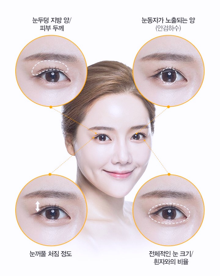 목동쌍수 잘하는 곳 찾는다면 3가지만 기억하세요 관련 이미지 3