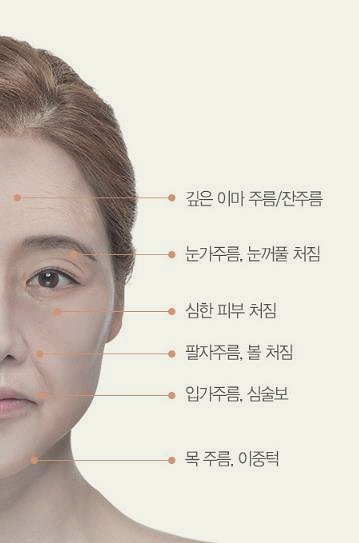 목동리프팅 잘하는 곳에서 추천하는 3가지 솔루션 관련 이미지 3