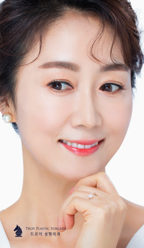 목동하안검 눈밑살처짐 고민에 좋은 이유 관련 이미지 3