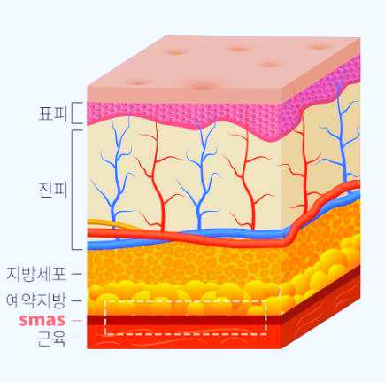 김포안면거상 흉터 관련 이미지 2