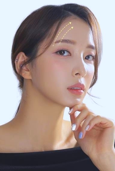 목동이마거상 vs 상안검 처진눈성형에 적합한 수술은? 관련 이미지 1