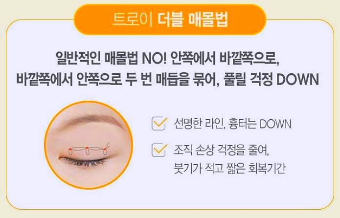 오목교쌍수 잘 하는 곳에서 알려주는 절개, 매몰 선택법 관련 이미지 3