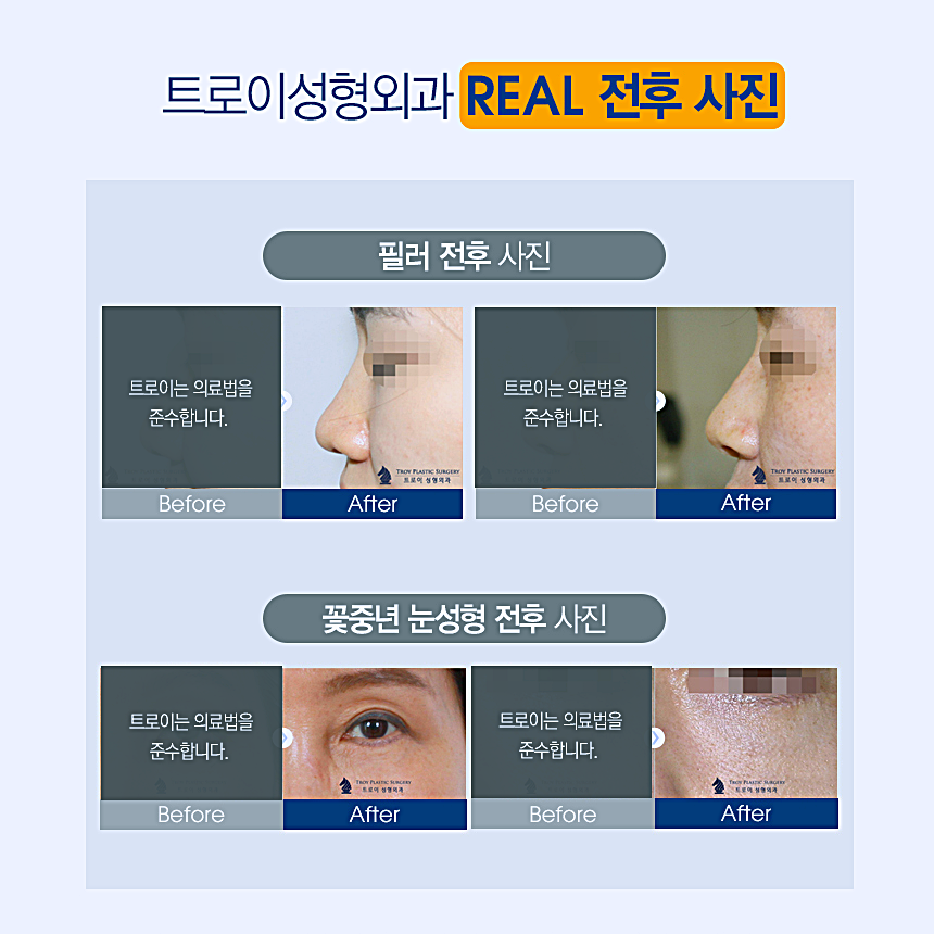 영등포성형외과 전문의가 직접 시수술을 주도하는 곳 관련 이미지 3