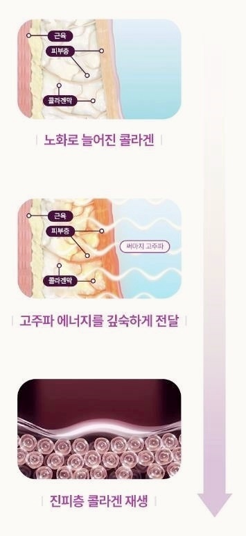 오목교피부과 써마지 잘하는 곳은 관련 이미지 4