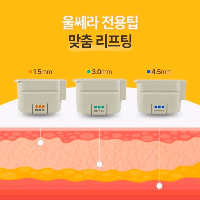 목동피부과 울쎄라 효과 제대로 보는 방법 관련 이미지 2