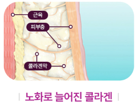 목동역 써마지 FLX, 탄력 리프팅에 효과 있을까? 관련 이미지 5