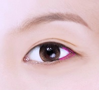 강서구 앞트임 뒤트임 중 나에게 필요한 수술은? 관련 이미지 2