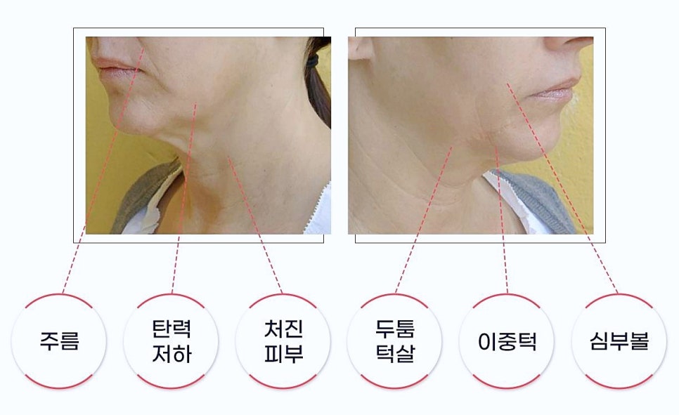 목동인모드 아무 데서나 받으면 후회합니다 관련 이미지 4