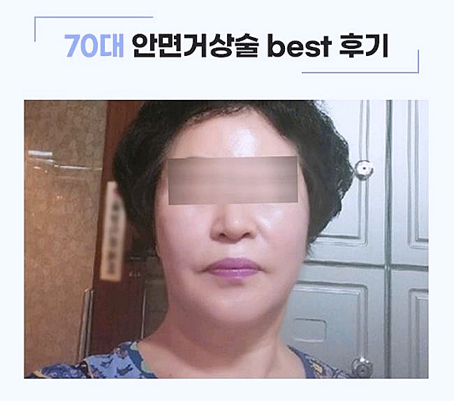 목동성형외과 이렇게 선택하면 실패 안합니다 관련 이미지 2