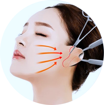 오목교리프팅 잘하는 곳에서 추천하는 3가지 솔루션 관련 이미지 5