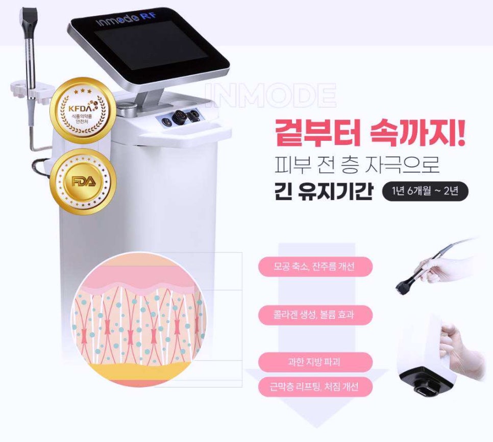목동인모드 효과 관련 이미지 1
