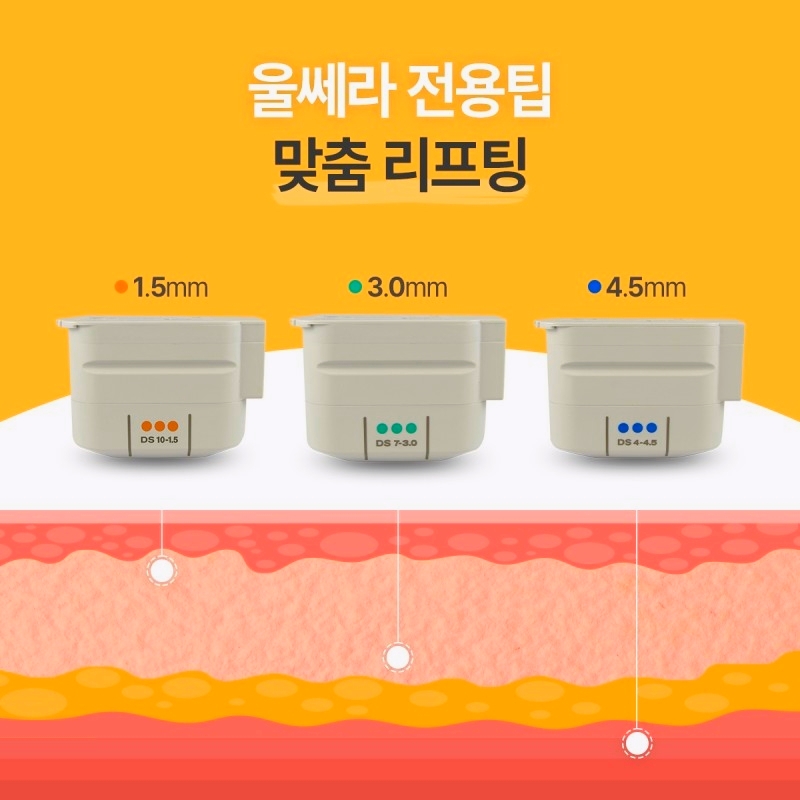 목동피부관리 울쎄라 레이저리프팅 성공 핵심 1가지 관련 이미지 2