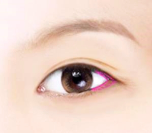 오목교성형외과 앞트임? 뒤트임? 나에게 필요한 트임성형은? 관련 이미지 2