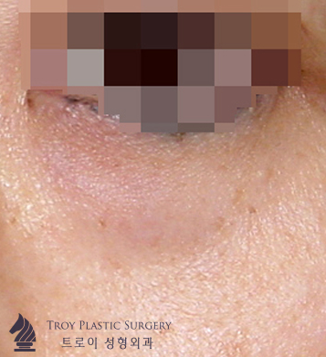 Where Is a Good Place for Under-Eye Fat Repositioning in Mok-dong? image 2