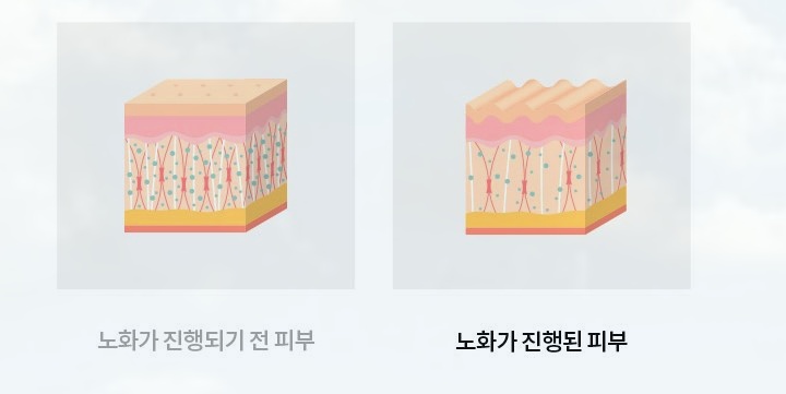 목동울쎄라 수술 없이 얼굴 처짐 고민 해결했어요 관련 이미지 1