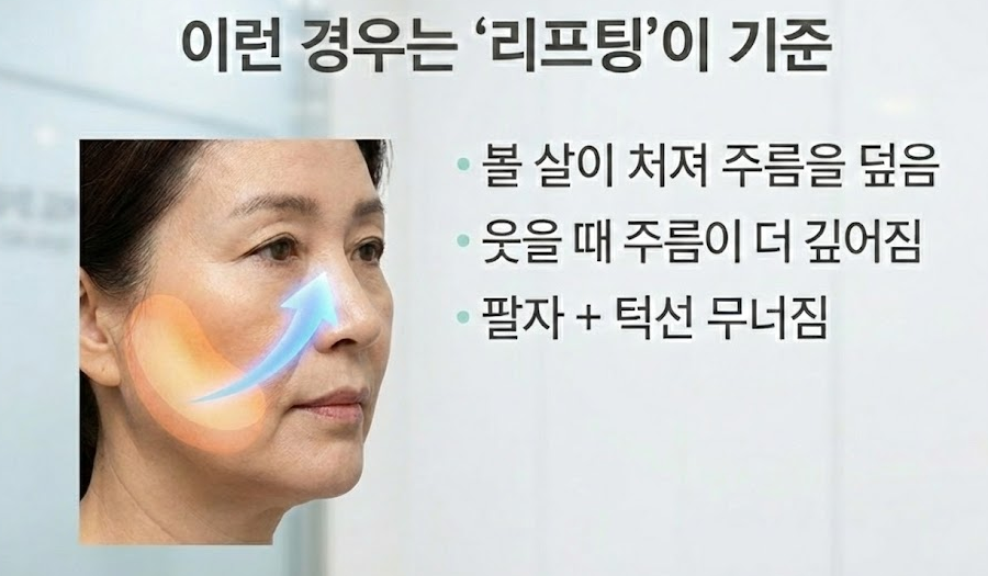Mokdong Nasolabial Folds: What Is the Standard Between Fillers and Lifting? image 4