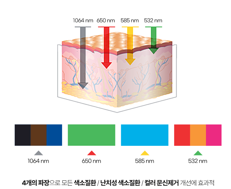 Eyeliner Tattoo Removal: Why Does Color Remain? Is Depth More Important Than Color? image 3