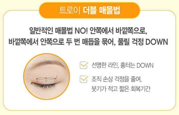 강서구쌍꺼풀 매몰 vs 절개, 모르고 받으면 후회합니다 관련 이미지 3