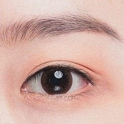 목동 쌍수 아웃라인? 인라인? 나에게 어울리는 라인 찾는 방법 관련 이미지 4