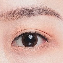 김포쌍수 인라인 vs 아웃라인 나에게 어울리는 라인 찾는 법 관련 이미지 4
