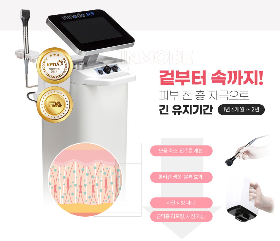 목동 인모드 포마, FX &mdash; 두 가지가 같이 언급되는 이유 관련 이미지 5