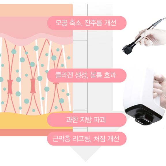 리프팅레이저, 울쎄라 슈링크 인모드 포텐자 차이 쉽게 정리 관련 이미지 4