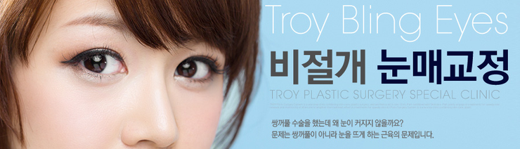 [목동성형외과] 비절개눈매교정 붓기 및 회복기간 관련 이미지 1