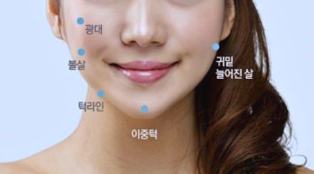 목동피부과 윤곽주사 볼패임 생기기 싫으면 보세요 관련 이미지 1