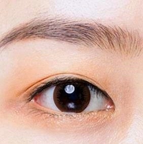 Mokdong Station Double Eyelid Surgery: Are the Surgical Methods Different for Protruding Eyes and Deep-Set Eyes? Don’t Regret Not Knowing image 1