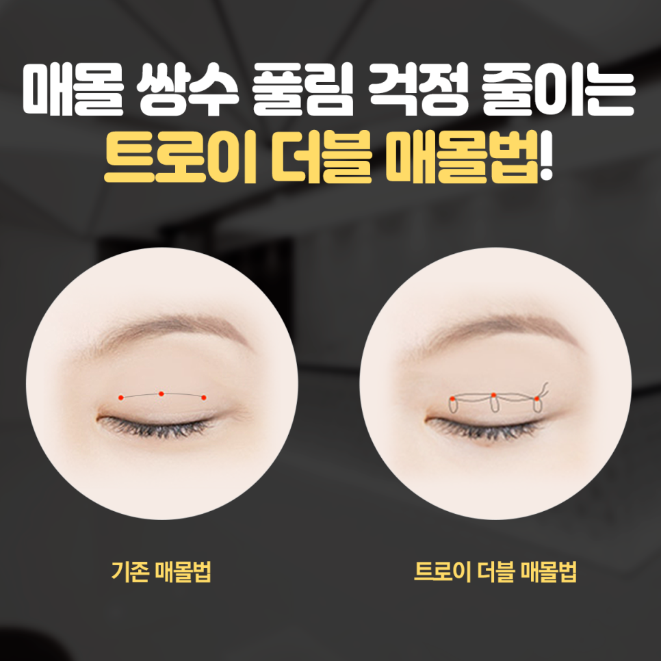 강서구쌍수 잘하는 곳 찾고 계시다면 보세요 관련 이미지 9