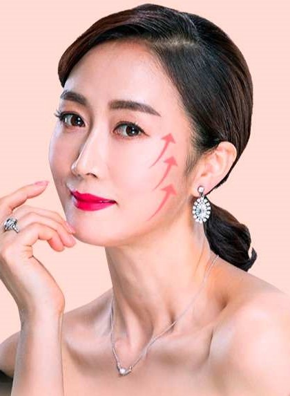 목동안면거상 흉터 걱정되시는 분들은 보세요 관련 이미지 3