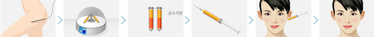 [트로이성형외과] 얼굴지방이식 오래 유지하는 방법은? 미세지방이식 관련 이미지 2