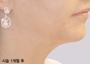영등포인모드 잘하는 곳? ‘이것’ 꼭 확인하세요 관련 이미지 5